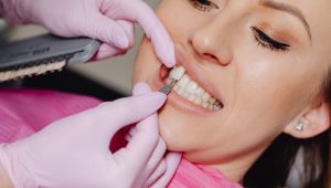 Does Insurance Cover Veneers? An In-Depth Guide